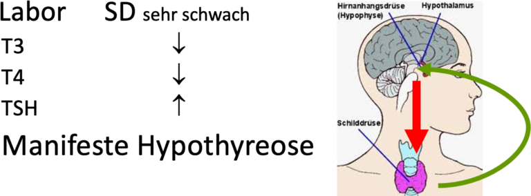Thyronajod 50 über Oder Unterfunktion schilddruesenordination-prasch.at